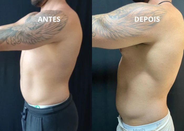 Nutrologo para hipertrofia